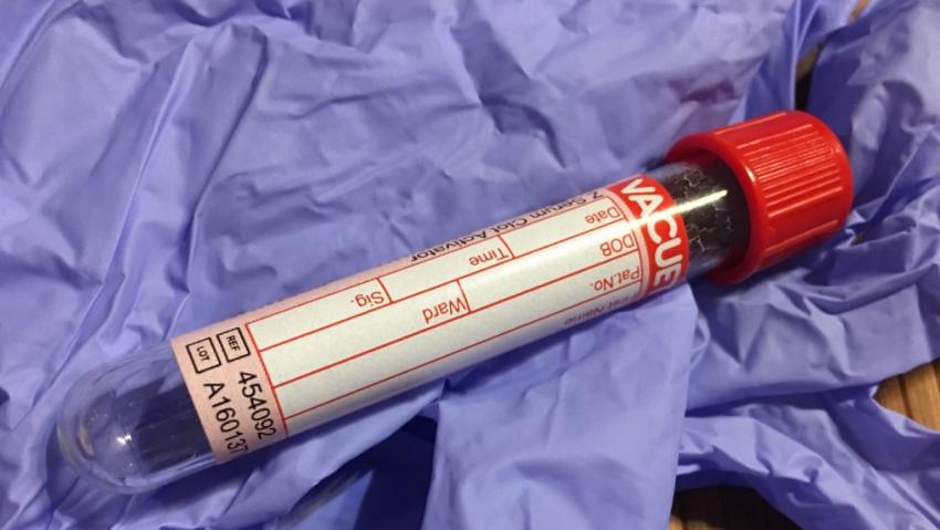 Учёные UKE выяснили, что контроль над болью менял её восприятие