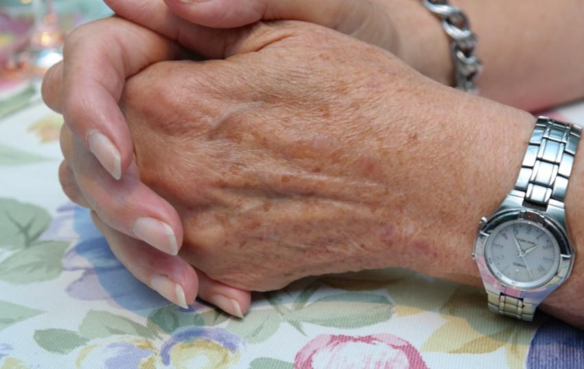 Белесые и желтые ногти могут сигнализировать о серьезных заболеваниях